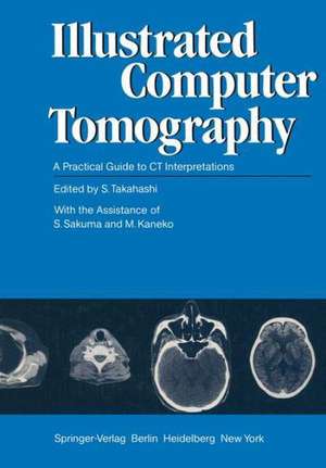 Illustrated Computer Tomography: A Practical Guide to CT Interpretations de S. Takahashi