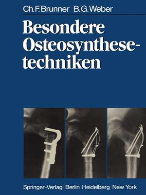 Besondere Osteosynthesetechniken de C. F. Brunner