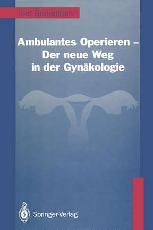 Ambulantes Operieren — Der neue Weg in der Gynäkologie: Der neue Weg in der Gynäkologie de Jost Brökelmann