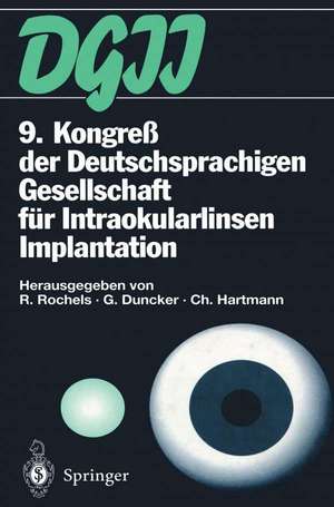 9. Kongreß der Deutschsprachigen Gesellschaft für Intraokularlinsen Implantation: 17. bis 19. März 1995, Kiel de Rainer Rochels