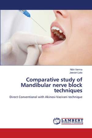 Comparative study of Mandibular nerve block techniques de Nitin Verma