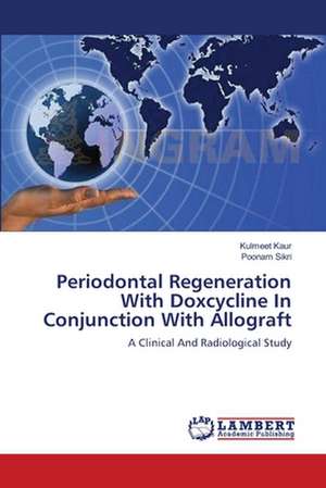 Periodontal Regeneration With Doxcycline In Conjunction With Allograft de Kulmeet Kaur