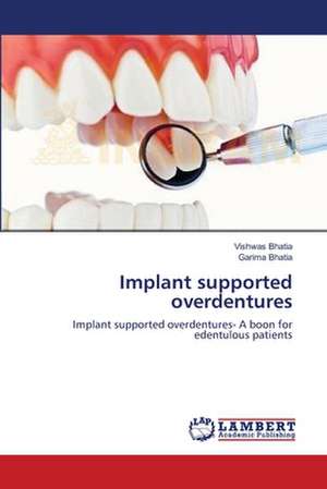 Implant supported overdentures de Vishwas Bhatia