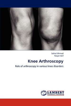 Knee Arthroscopy de Sohail Ahmad