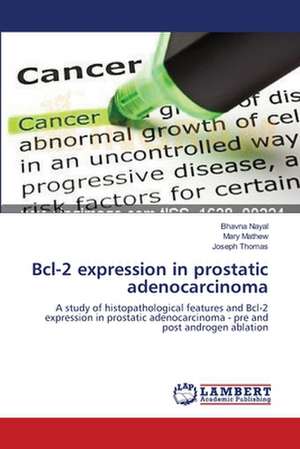 Bcl-2 expression in prostatic adenocarcinoma de Bhavna Nayal