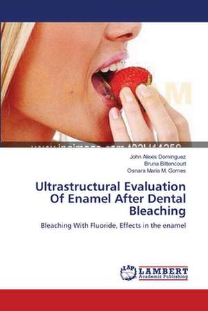 Ultrastructural Evaluation Of Enamel After Dental Bleaching de John Alexis Dominguez