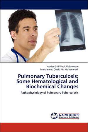 Pulmonary Tuberculosis; Some Hematological and Biochemical Changes de Hayder Gali Wadi Al-Gawwam