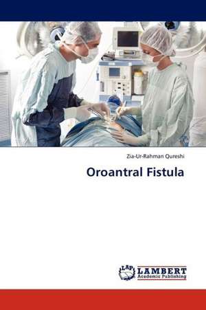 Oroantral Fistula de Qureshi Zia-Ur-Rahman