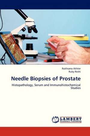 Needle Biopsies of Prostate de Rukhsana Akhter