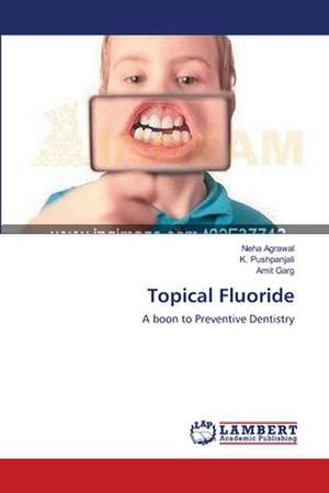 Topical Fluoride de Agrawal Neha