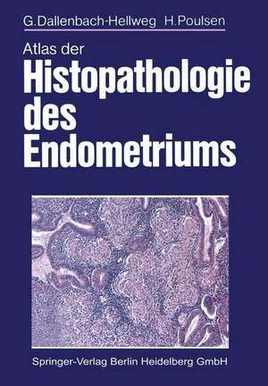 Atlas der Histopathologie des Endometriums de G. Dallenbach-Hellweg