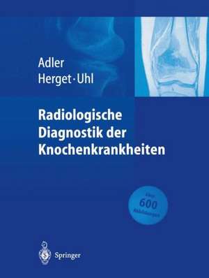 Radiologische Diagnostik der Knochenkrankheiten de T. Zajic