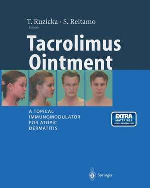 Tacrolimus Ointment: A Topical Immunomodulator for Atopic Dermatitis de T. Ruzicka