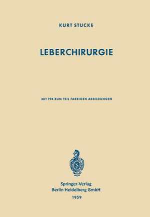 Leberchirurgie: Grundlagen · Grenzen · Möglichkeiten de K. Stucke