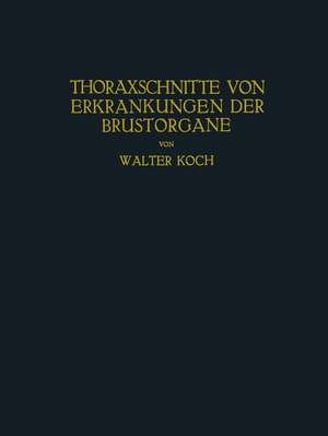 Thoraxschnitte von Erkrankungen der Brustorgane: Ein Atlas de Walter Koch