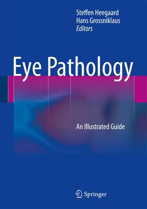 Eye Pathology: An Illustrated Guide de Steffen Heegaard