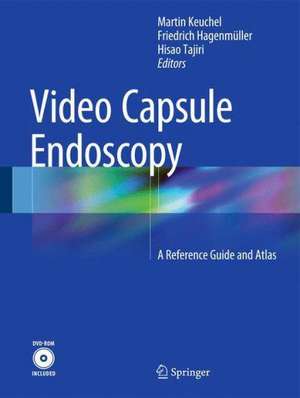 Video Capsule Endoscopy: A Reference Guide and Atlas de Martin Keuchel