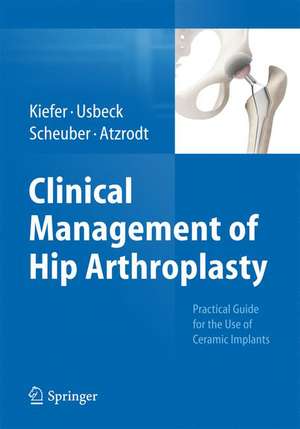 Clinical Management of Hip Arthroplasty: Practical Guide for the Use of Ceramic Implants de Hartmuth Kiefer