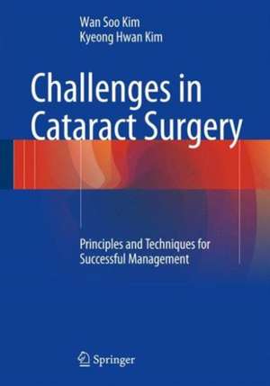 Challenges in Cataract Surgery: Principles and Techniques for Successful Management de Wan Soo Kim