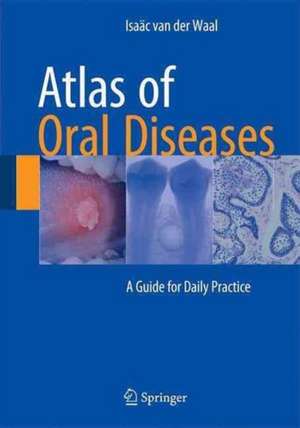 Atlas of Oral Diseases: A Guide for Daily Practice de Isaäc van der Waal