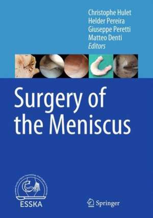 Surgery of the Meniscus de Christophe Hulet