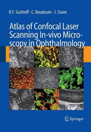 Atlas of Confocal Laser Scanning In-vivo Microscopy in Ophthalmology de R.F. Guthoff