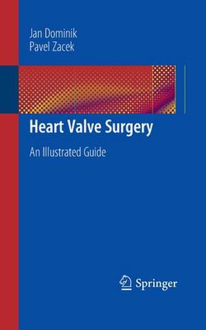 Heart Valve Surgery: An Illustrated Guide de Jan Dominik