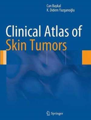 Clinical Atlas of Skin Tumors de Can Baykal