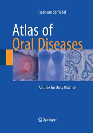 Atlas of Oral Diseases: A Guide for Daily Practice de Isaäc van der Waal