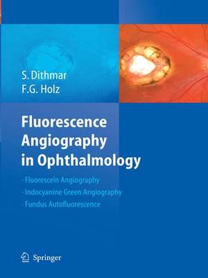 Fluorescence Angiography in Ophthalmology de Stefan Dithmar