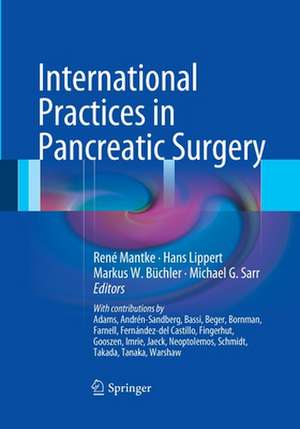 International Practices in Pancreatic Surgery de René Mantke