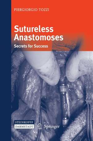 Sutureless Anastomoses: Secrets for Success de Piergiorgio Tozzi