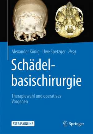 Schädelbasischirurgie: Therapiewahl und operatives Vorgehen de Alexander König