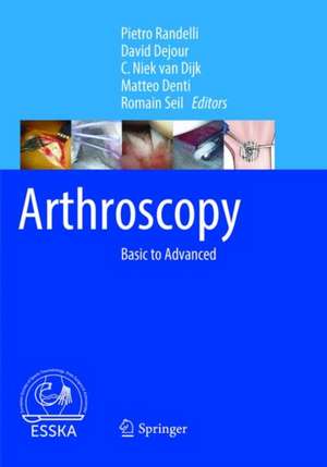 Arthroscopy: Basic to Advanced de David Dejour