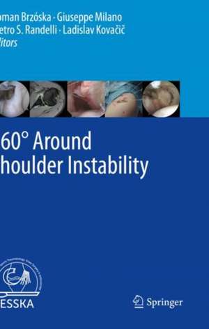 360° Around Shoulder Instability de Roman Brzóska