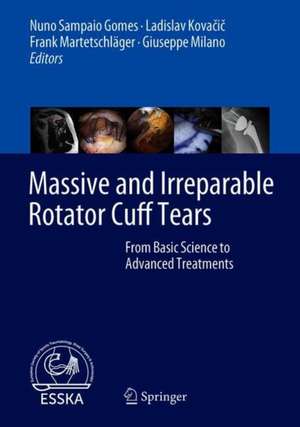 Massive and Irreparable Rotator Cuff Tears: From Basic Science to Advanced Treatments de Nuno Sampaio Gomes