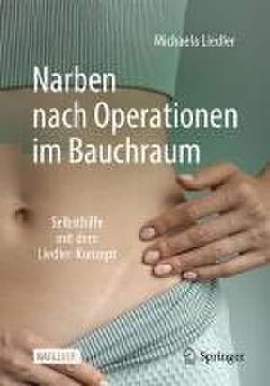 Narben nach Operationen im Bauchraum: Selbsthilfe mit dem Liedler-Konzept de Michaela Liedler