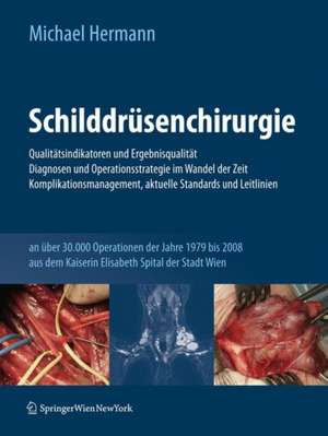 Schilddrüsenchirurgie - Qualitätsindikatoren und Ergebnisqualität, Diagnosen und Operationsstrategie im Wandel der Zeit, Komplikationsmanagement, aktuelle Standards und Leitlinien: an über 30.000 Operationen der Jahre 1979-2008 aus dem Kaiserin Elisabeth Spital der Stadt Wien de Michael Hermann