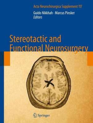 Stereotactic and Functional Neurosurgery de Guido Nikkhah