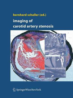 Imaging of Carotid Artery Stenosis de Bernhard Schaller