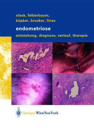 Endometriose: Entstehung, Diagnose, Verlauf und Therapie de Thomas Steck