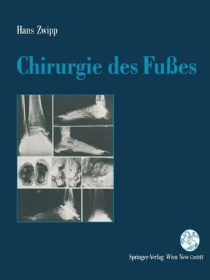 Chirurgie des Fußes de Hans Zwipp