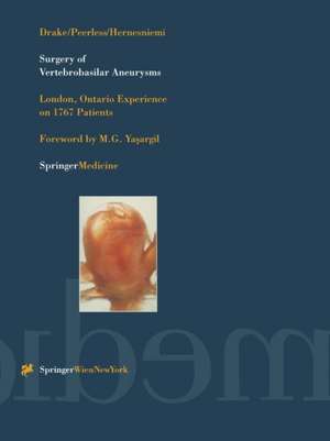 Surgery of Vertebrobasilar Aneurysms: London, Ontario Experience on 1767 Patients de Charles G. Drake