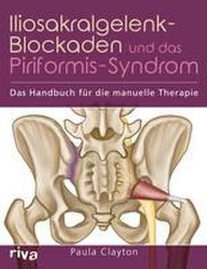 Iliosakralgelenk-Blockaden und das Piriformis-Syndrom de Paula Clayton