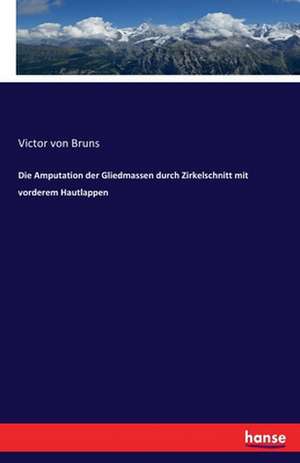 Die Amputation der Gliedmassen durch Zirkelschnitt mit vorderem Hautlappen de Victor Von Bruns