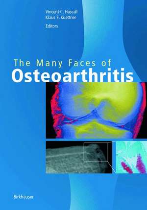 The Many Faces of Osteoarthritis de Vincent C. Hascall