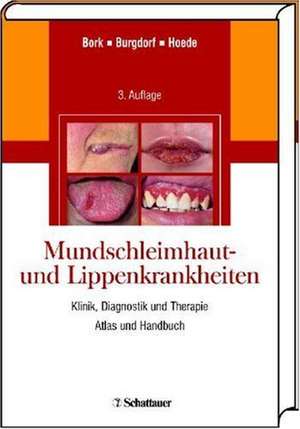 Mundschleimhaut- und Lippenkrankheiten de Konrad Bork