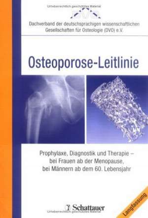 Evidenzbasierte Konsensus-Leitlinie zur Osteoporose