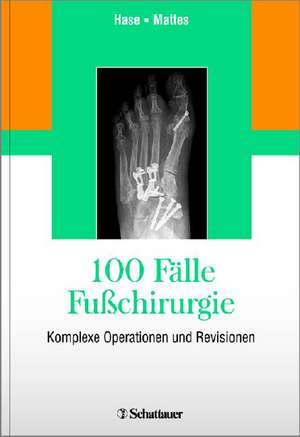 100 Fälle Fußchirurgie de Charlotte Hase