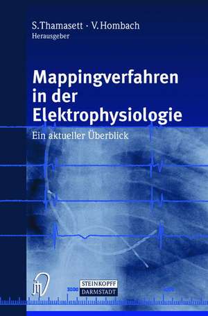 Mappingverfahren in der Elektrophysiologie: Ein aktueller Überblick de S. Thamasett